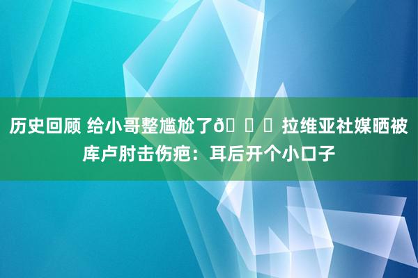 历史回顾 给小哥整尴尬了😅拉维亚社媒晒被库卢肘击伤疤：耳后开个小口子